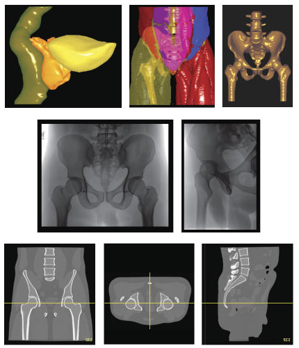 Virtually Human Male Pelvis Phantom X-Ray and CT Images
