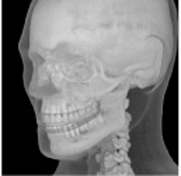ATOMmax 3D CT Reconstruction