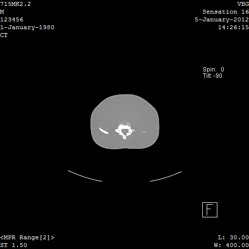 SPoRT CT Image 31