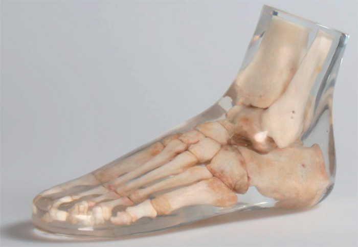 natural bone foot erler zimmer