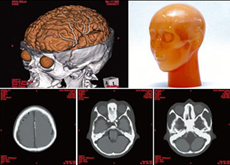 Phantom and CT Scan Image