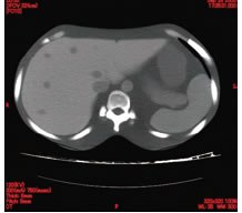 Phantom CT Image