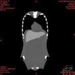 PBU CT Scan Front Torso