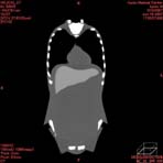 PBU CT Scan Front Torso