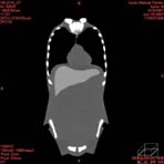 PBU CT Scan Front Torso