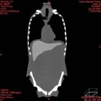 PBU CT Scan Front Torso