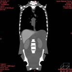 PBU CT Scan Front Torso