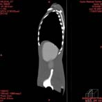 PBU CT Scan Side Torso