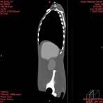 PBU CT Scan Side Torso