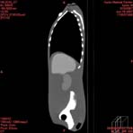 PBU CT Scan Side Torso