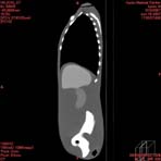 PBU CT Scan Side Torso