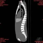 PBU CT Scan Side Torso