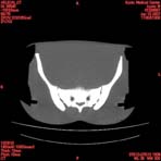 PBU CT Scan Torso Slice