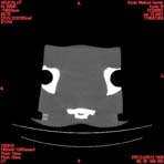 PBU CT Scan Torso Slice