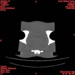 PBU CT Scan Torso Slice