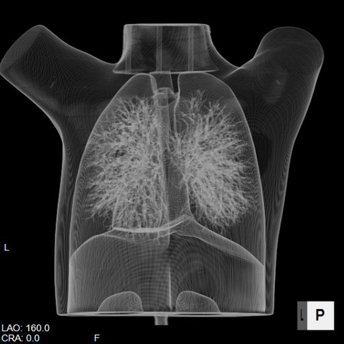 Pediatric Chest Phantom - PH-1C "LUNGBOY" Kyoto Kagaku