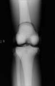 PBU-50 X-ray Knee Scan