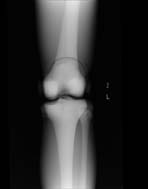 PBU-50 X-ray Knee Scan