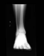 PBU-50 X-ray Foot Scan