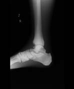 PBU-50 X-ray Foot Side Scan