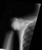 PBU-50 X-ray Shoulder Scan