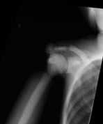 PBU-50 X-ray Shoulder Scan