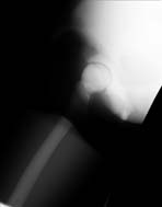 PBU-50 X-ray Scan