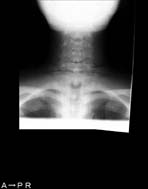 PBU-50 X-ray Neck Scan