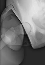 PBU-50 X-ray Hip Scan