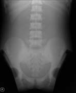 PBU-50 X-ray Chest Scan