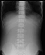 PBU-50 X-ray Abdomen Scan