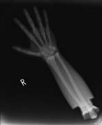 PBU-50 X-ray Hand Scan