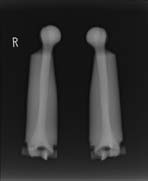 PBU-50 X-ray Legs Scan