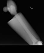 PBU-50 X-ray Arm Scan