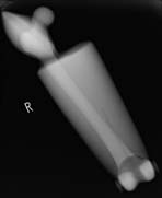 PBU-50 X-ray Arm Scan