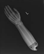 PBU-50 X-ray Hand Scan