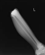 PBU-50 X-ray Leg Scan