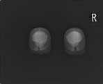PBU-50 X-ray Scan
