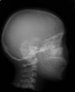 PBU-50 X-ray Head Side Scan