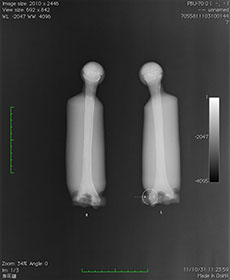 PBU-70 Upper Arm X-Ray