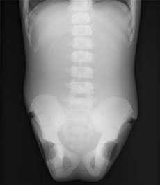 PBU-70 Trunk X-Ray