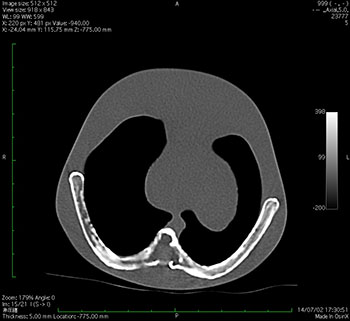 Whole Body Newborn Baby Phantom - CT Image 2