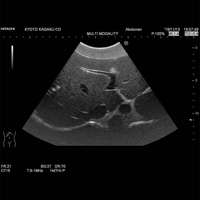 Dual Modality Human Abdomen Phantom (CT, Ultrasound) - US-22 - Kyoto Kagaku - Ultrasound