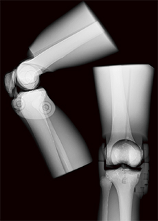 Kyoto Kagaku Knee