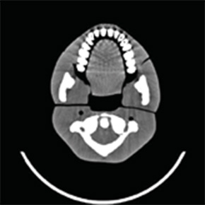 Dental Radiography Head Phantom - PH-47 - Kyoto Kagaku