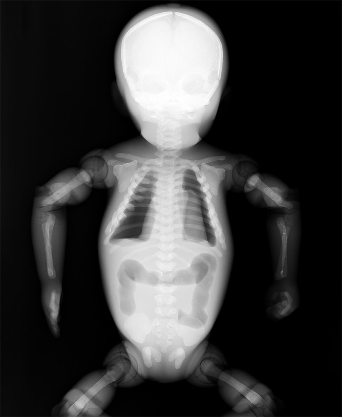 Newborn Whole Body Phantom "PBU-80" - Kyoto Kagaku - PH-50B - xray image 1