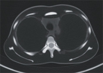 PBU X-Ray Training Manikin - Patient Simulator for X-Ray Positioning - Abdomen CT 1