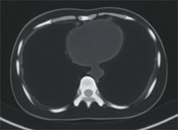 PBU X-Ray Training Manikin - Patient Simulator for X-Ray Positioning - Abdomen CT 2