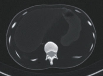 PBU X-Ray Training Manikin - Patient Simulator for X-Ray Positioning - Abdomen CT 3