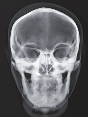 PBU X-Ray Training Manikin - Patient Simulator for X-Ray Positioning - X-Ray 1